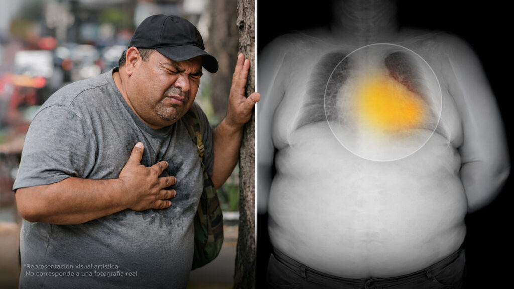 Antes de un infarto, tu cuerpo manda estas 3 señales – Vertikal